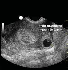 MRI Image Preview