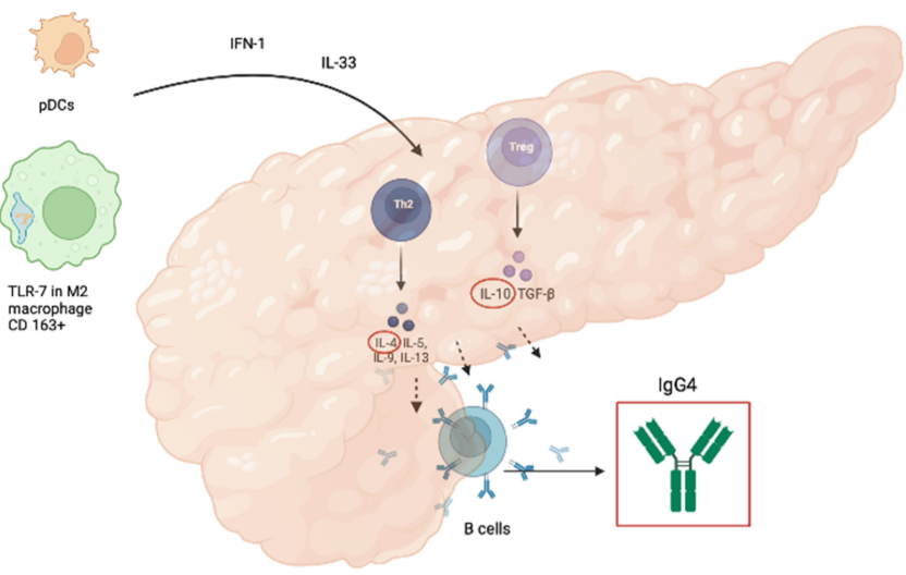 Viêm tụy tự miễn (Autoimmune Pancreatitis - AIP) 