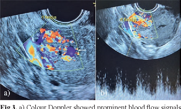 MRI Image Preview