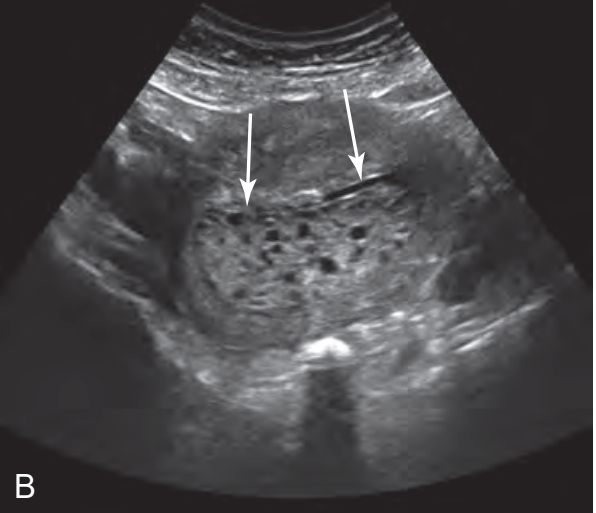 MRI Image Preview