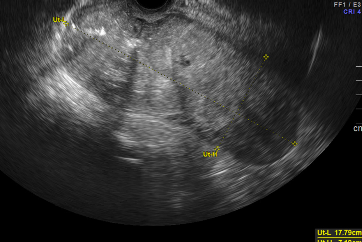 MRI Image Preview