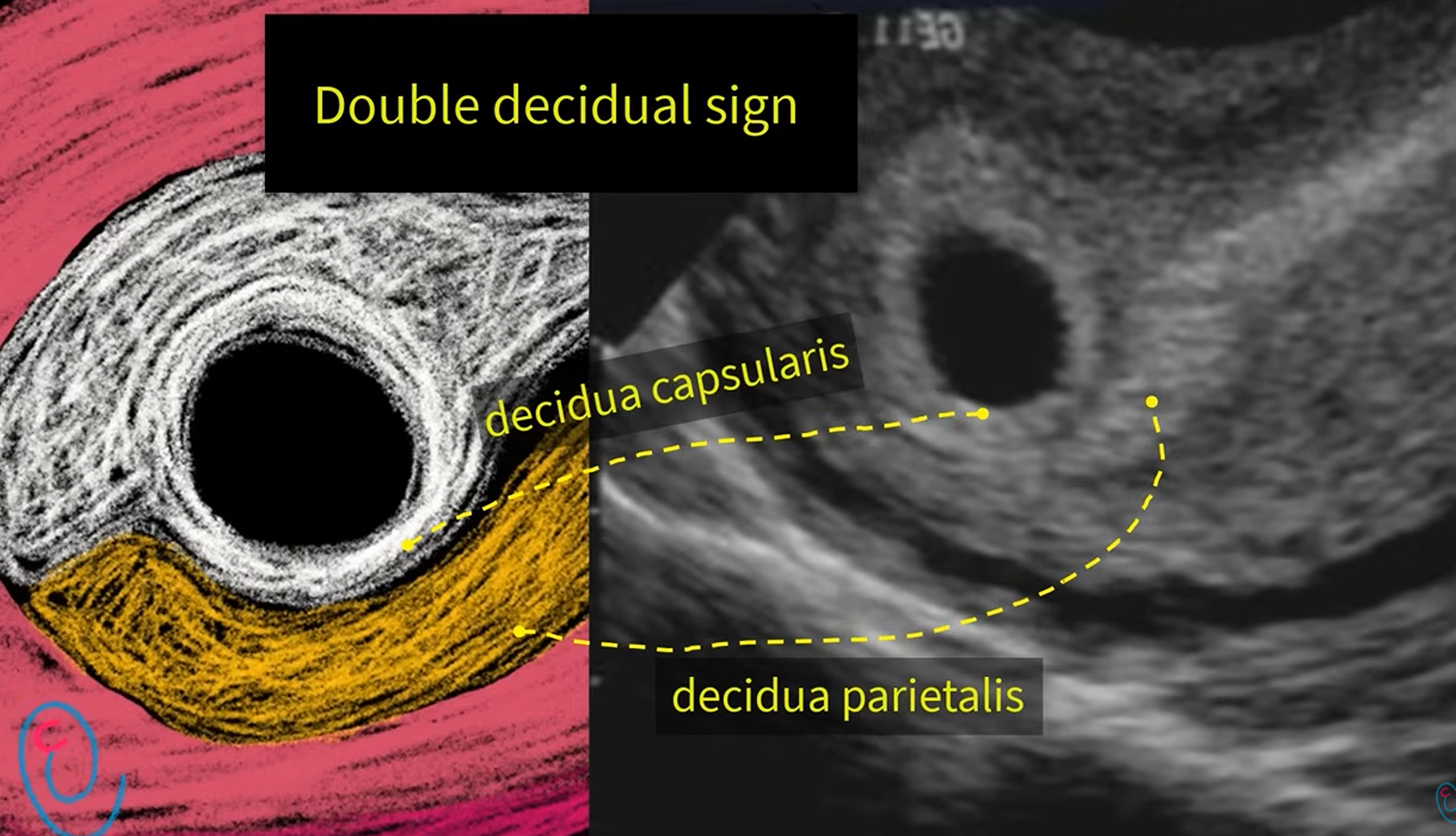 MRI Image Preview