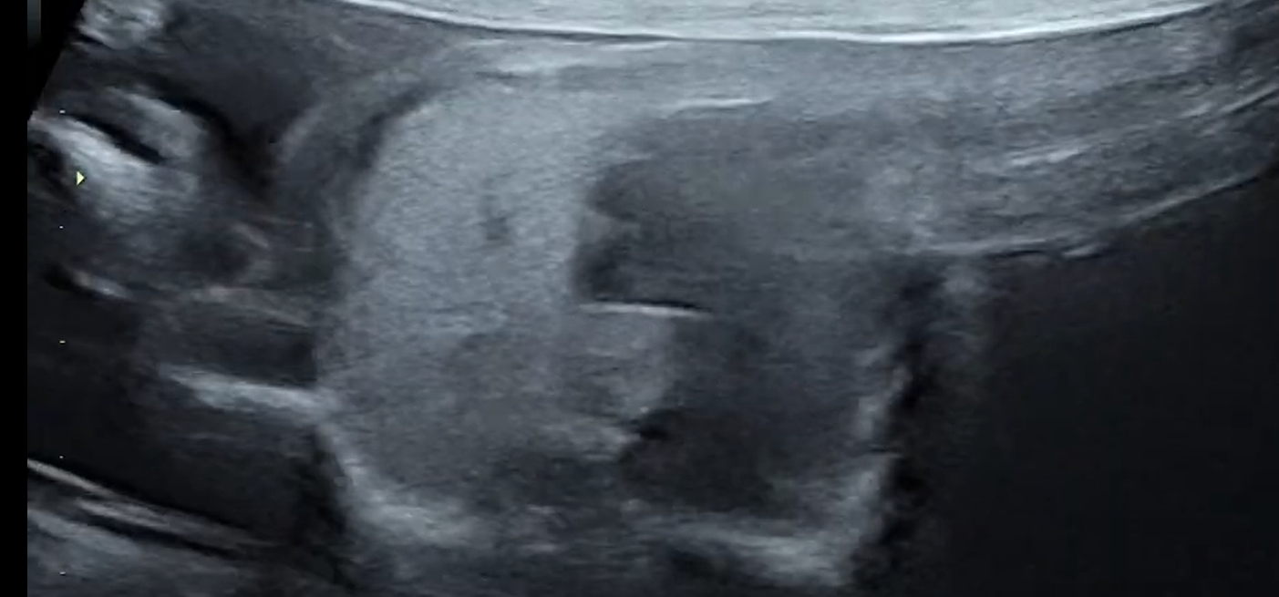 MRI Image Preview