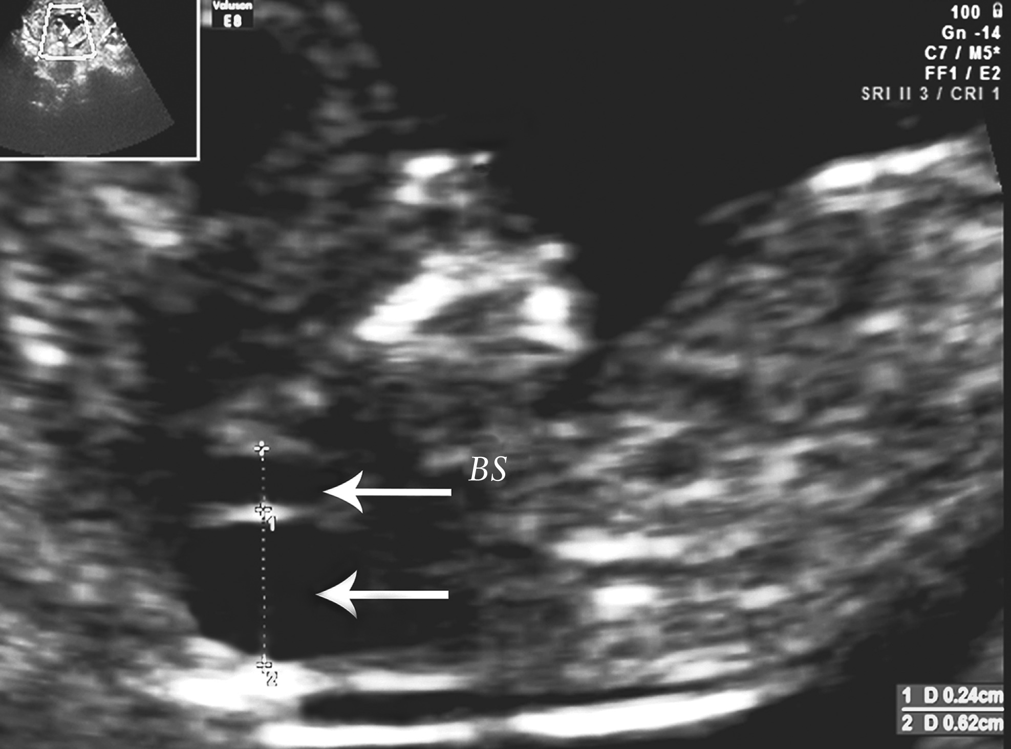 MRI Image Preview