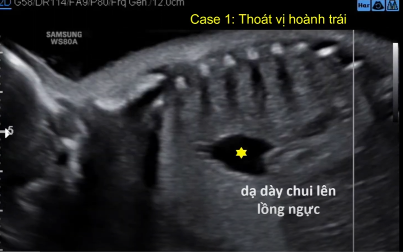 MRI Image Preview