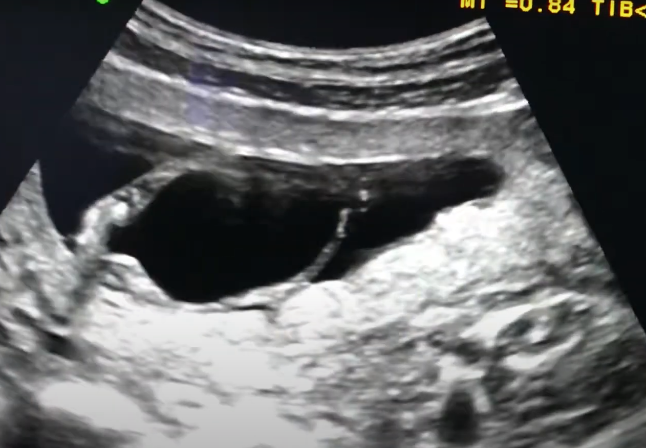 MRI Image Preview