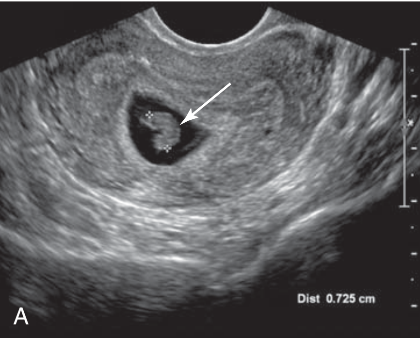 MRI Image Preview