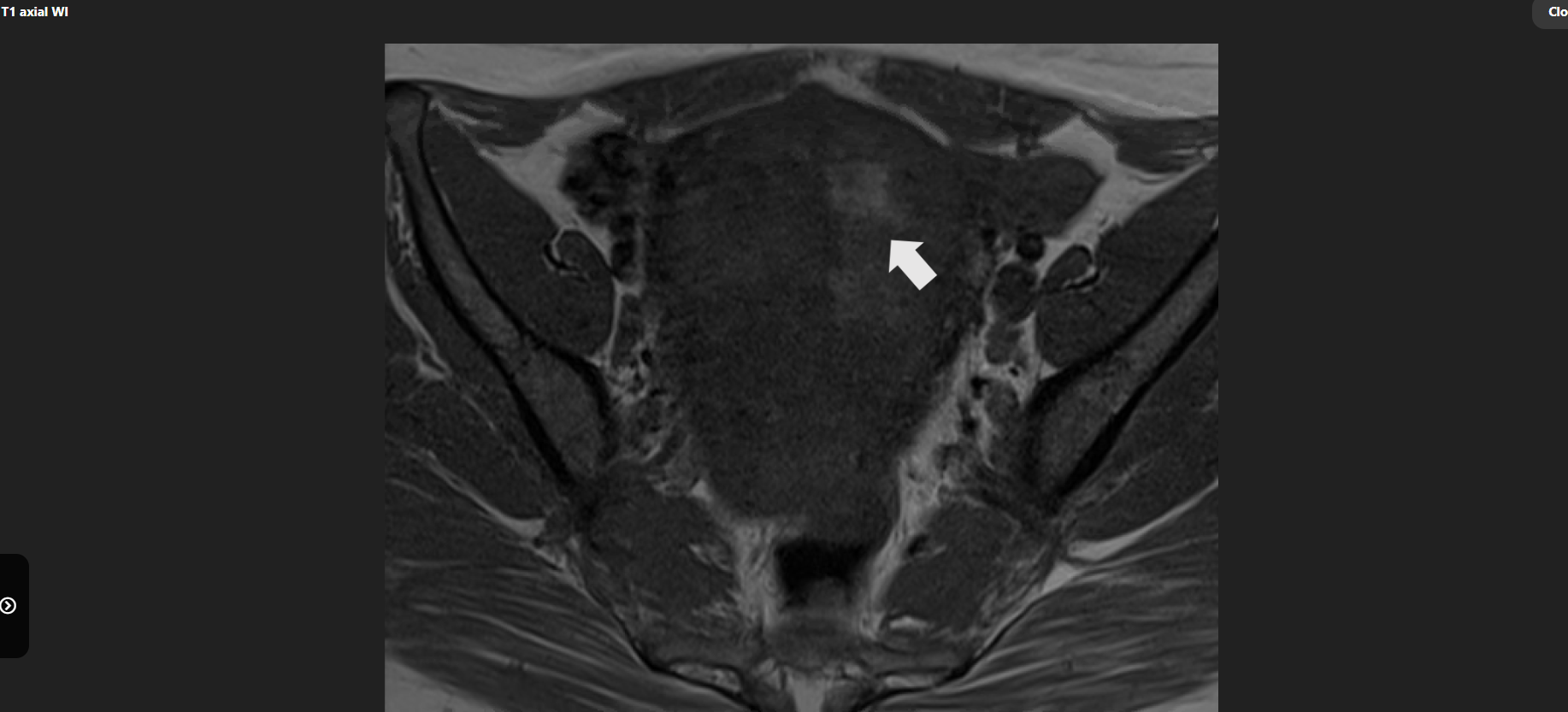 MRI Image Preview