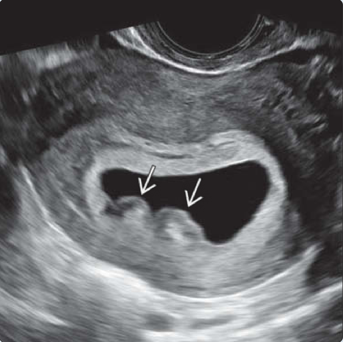 MRI Image Preview