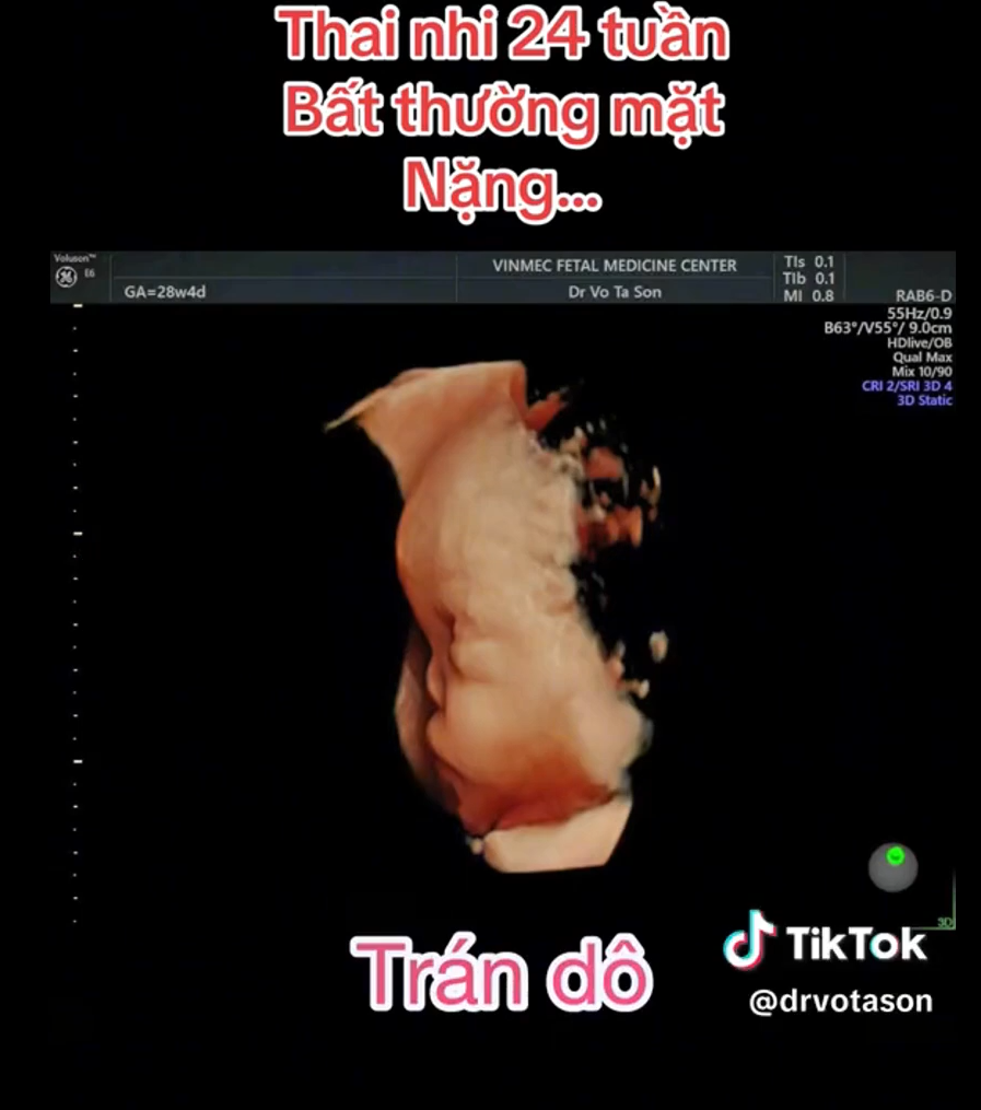MRI Image Preview