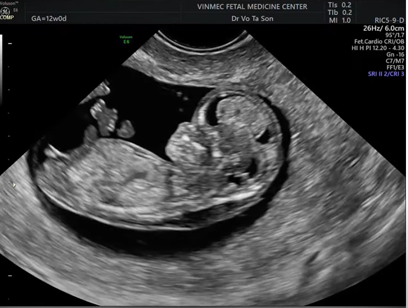 MRI Image Preview
