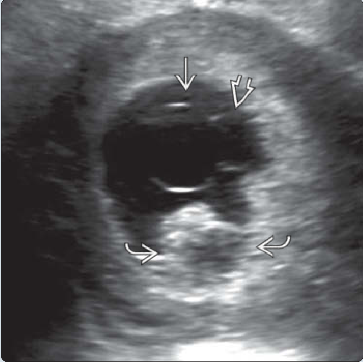 MRI Image Preview