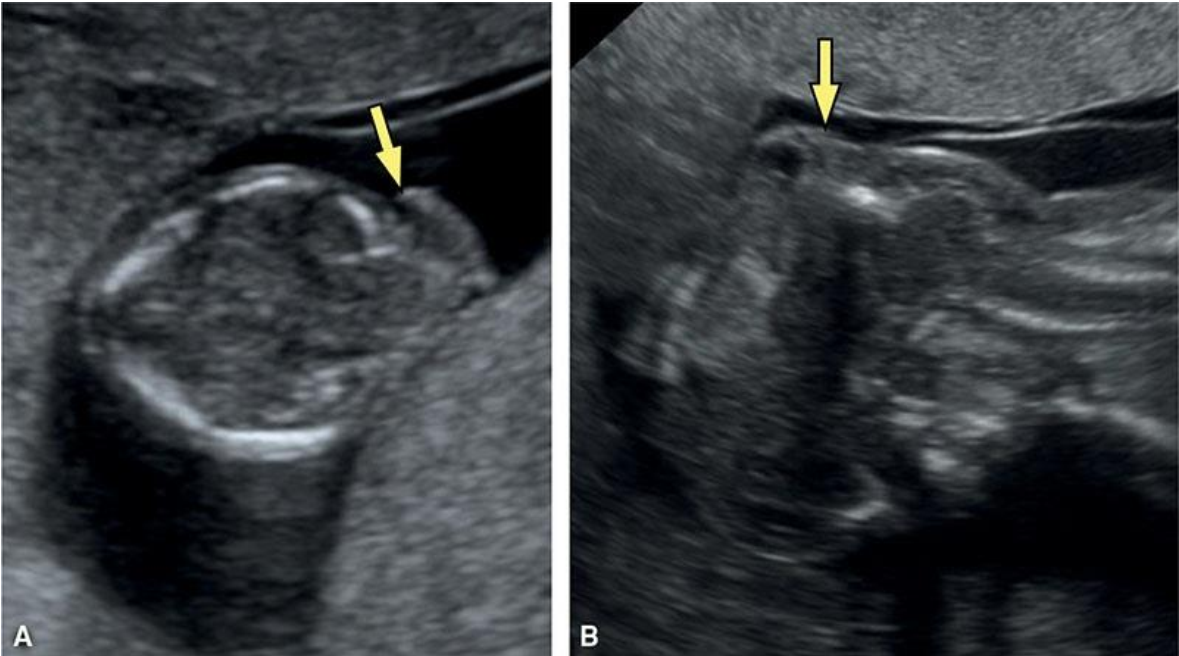 MRI Image Preview