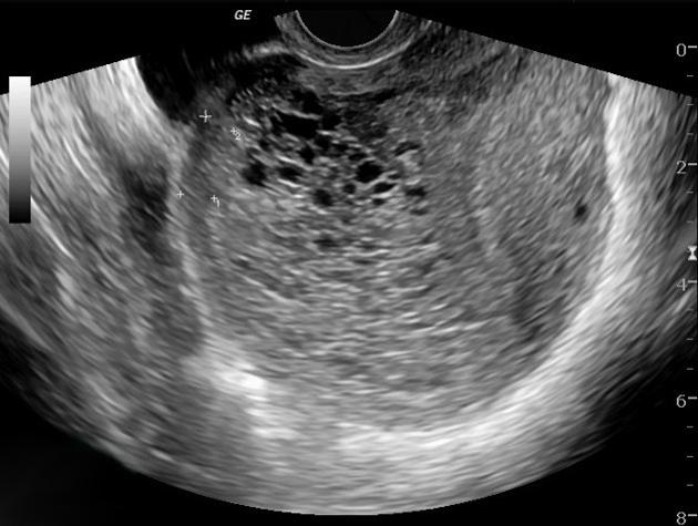 MRI Image Preview