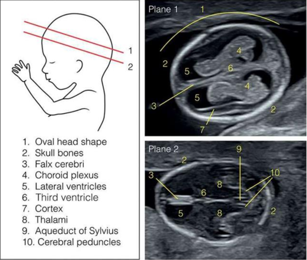 MRI Image Preview