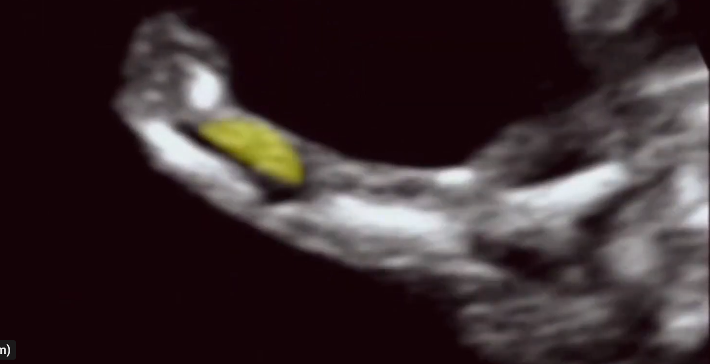 MRI Image Preview