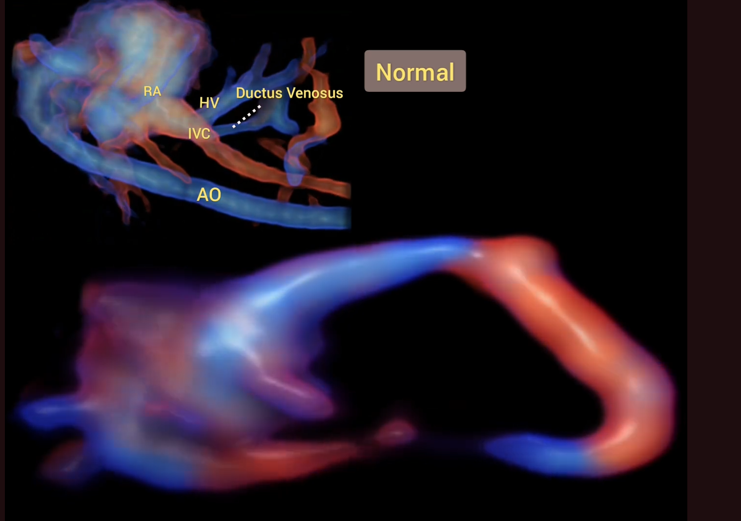 MRI Image Preview