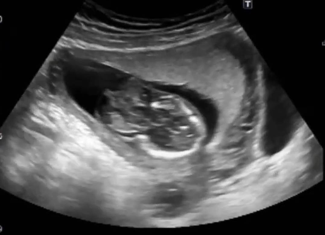 MRI Image Preview