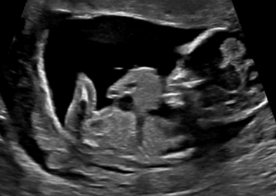 MRI Image Preview