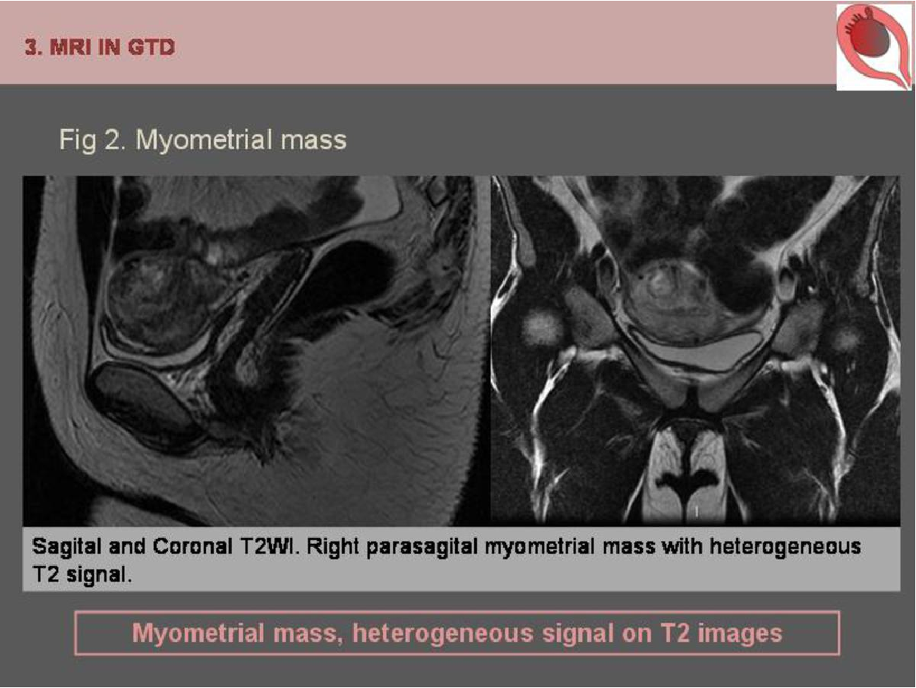 MRI Image Preview