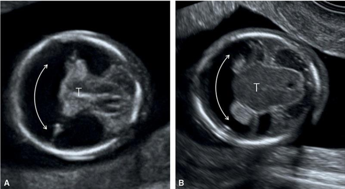 MRI Image Preview