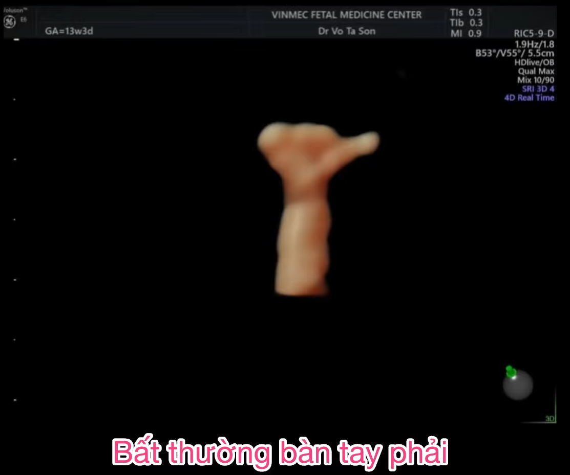 MRI Image Preview