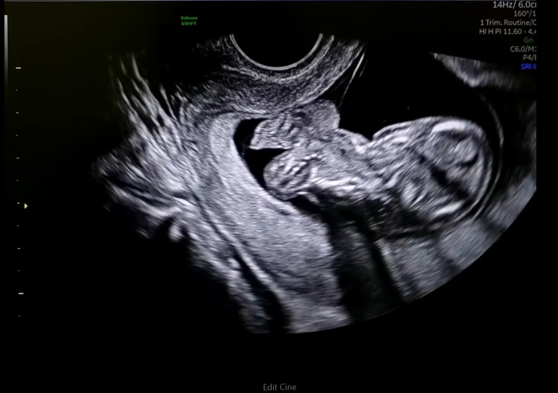 MRI Image Preview