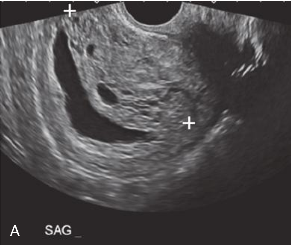 MRI Image Preview
