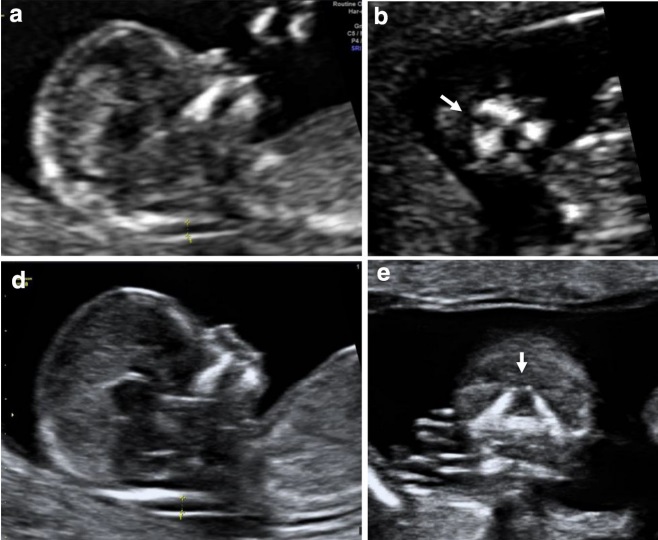 MRI Image Preview