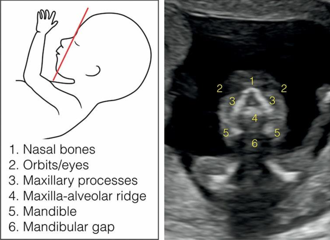 MRI Image Preview