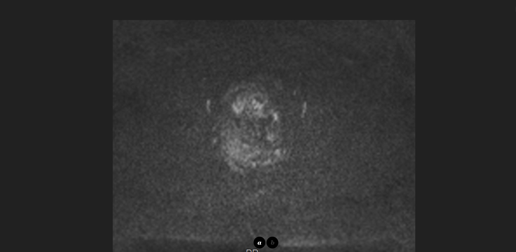 MRI Image Preview