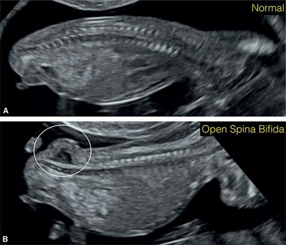 MRI Image Preview