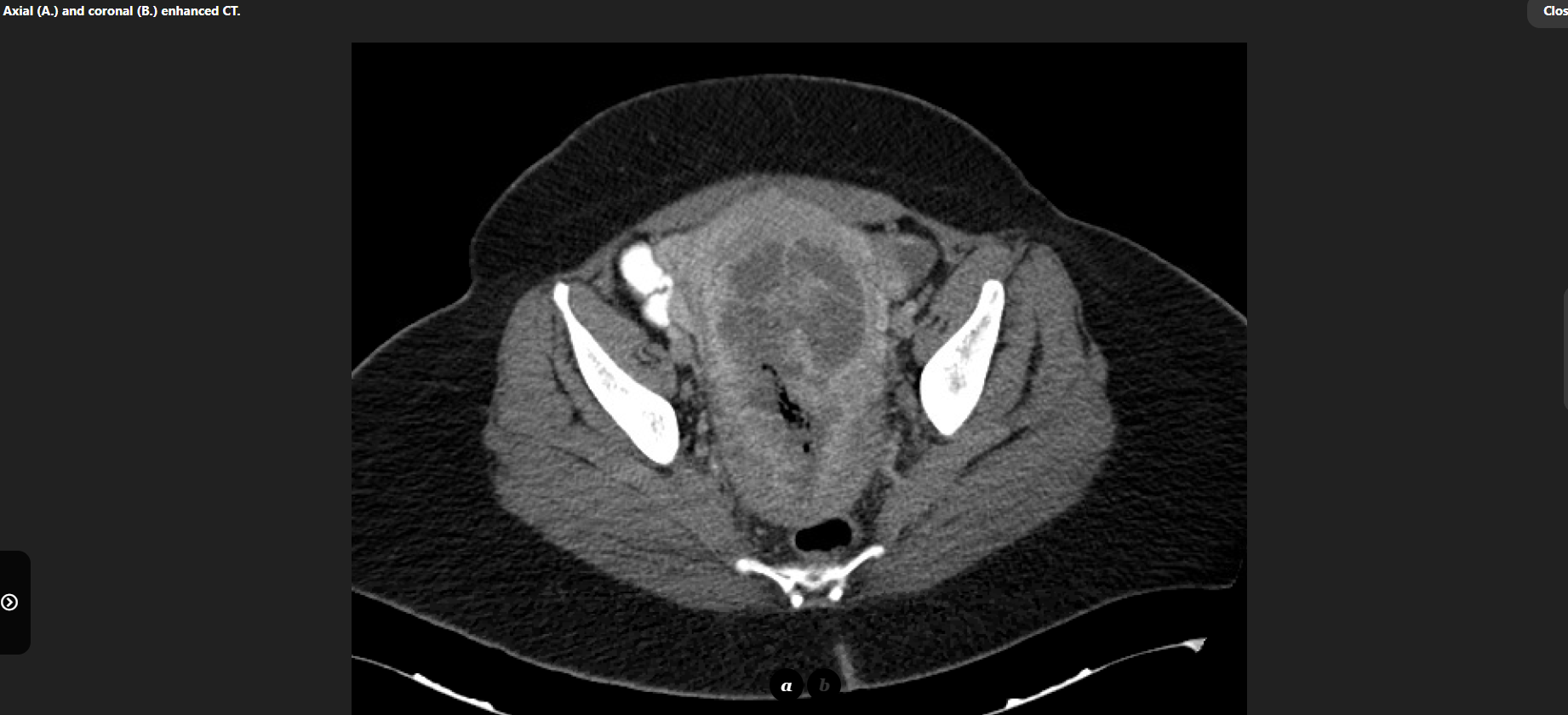 MRI Image Preview