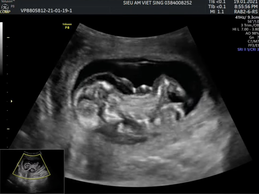 MRI Image Preview