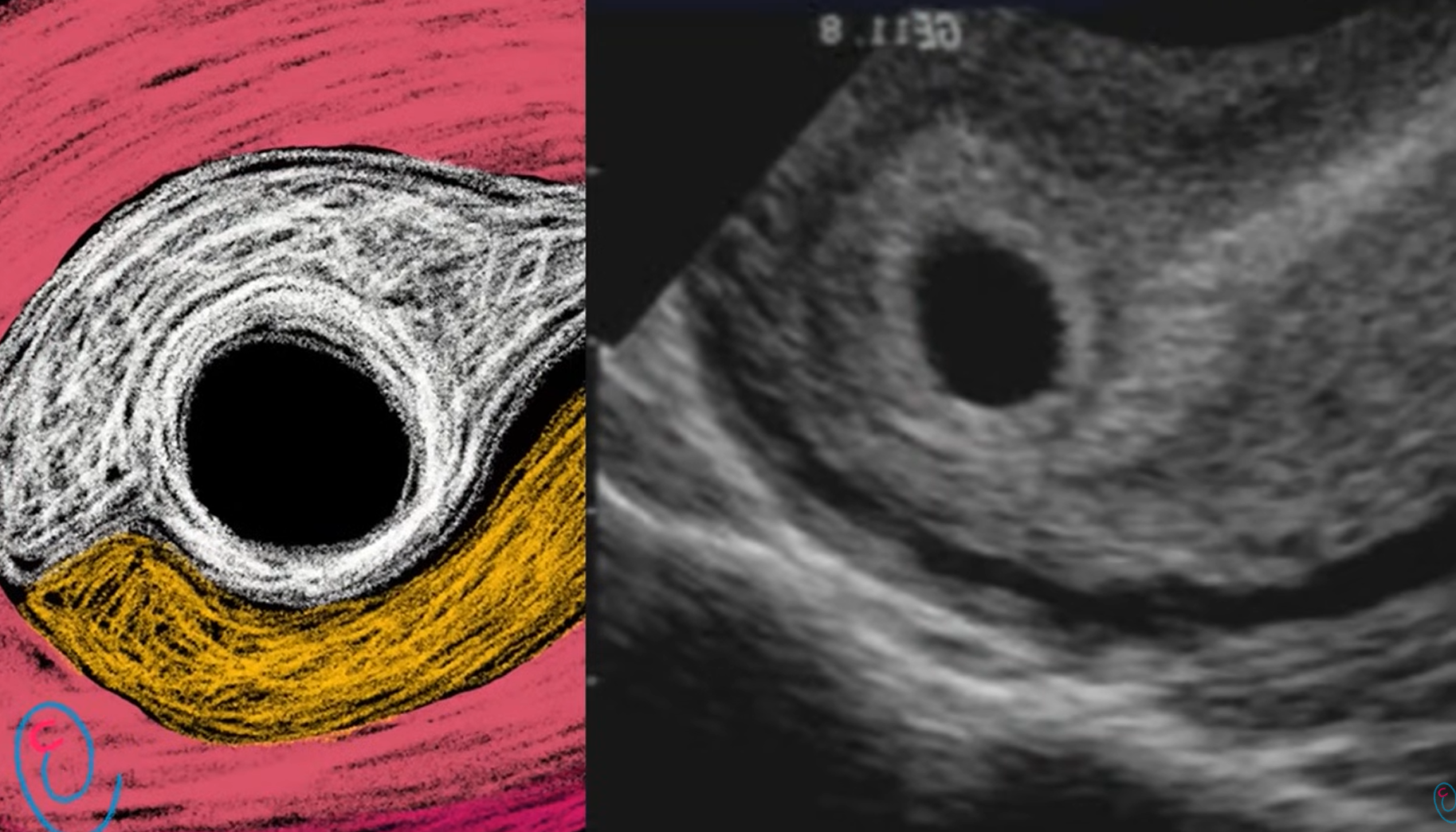 MRI Image Preview