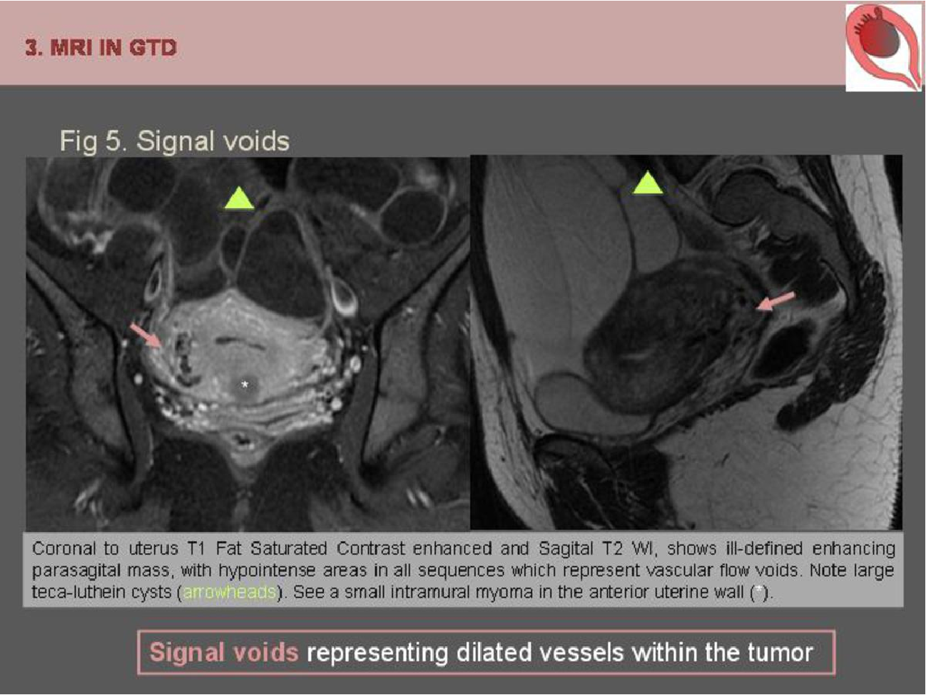 MRI Image Preview
