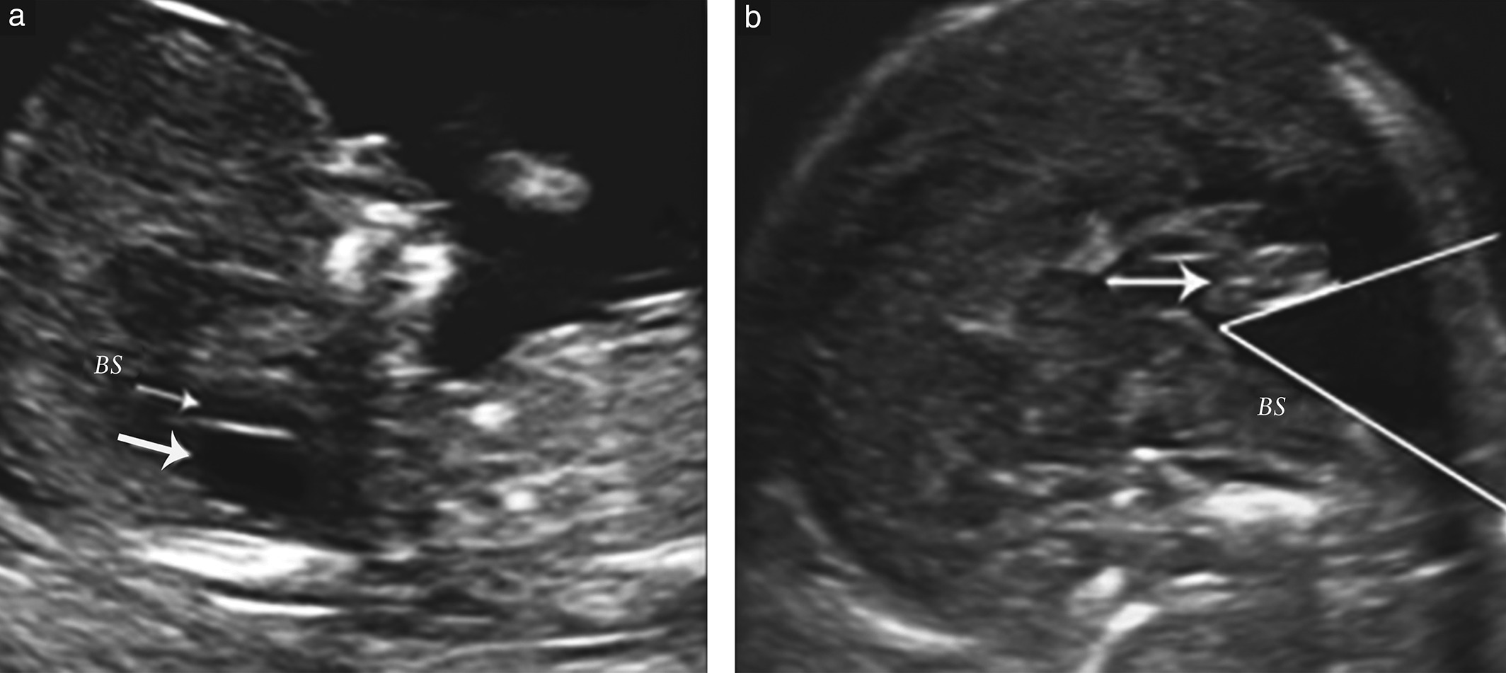 MRI Image Preview