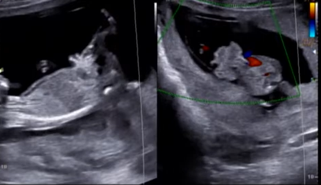 MRI Image Preview