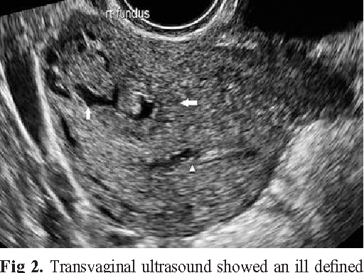 MRI Image Preview
