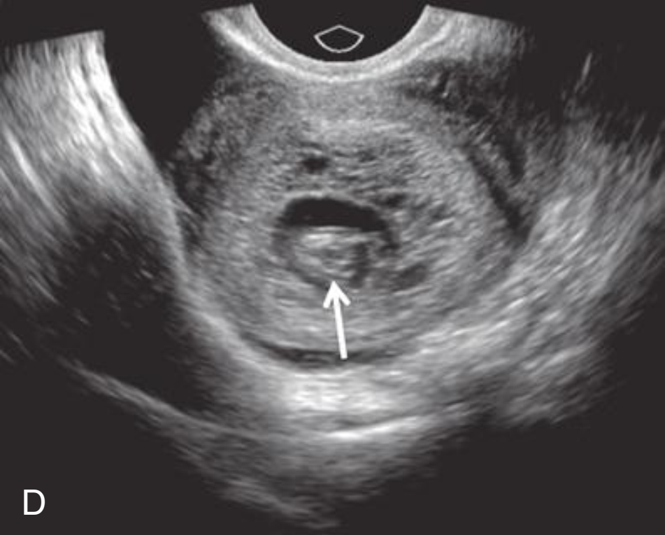 MRI Image Preview