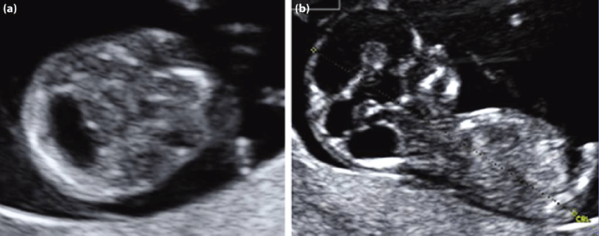 MRI Image Preview