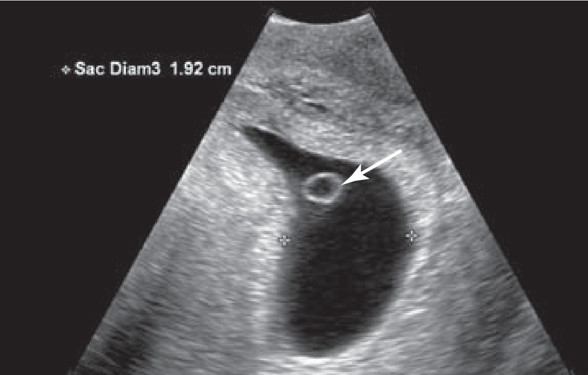 MRI Image Preview