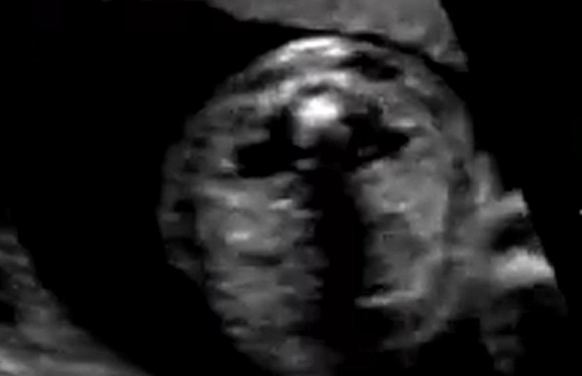 MRI Image Preview
