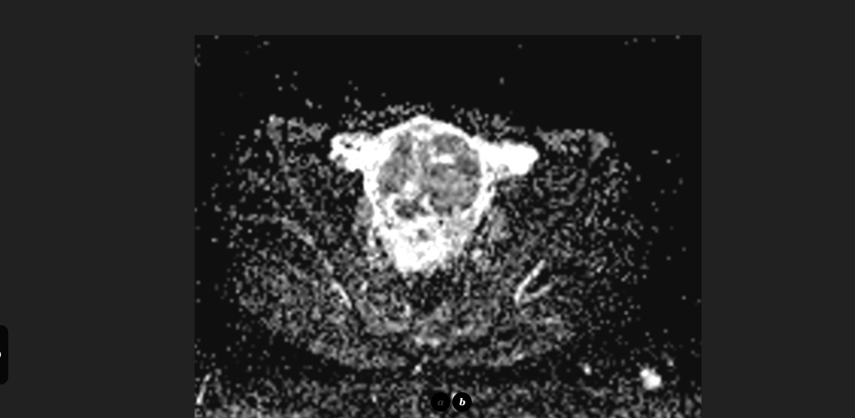 MRI Image Preview