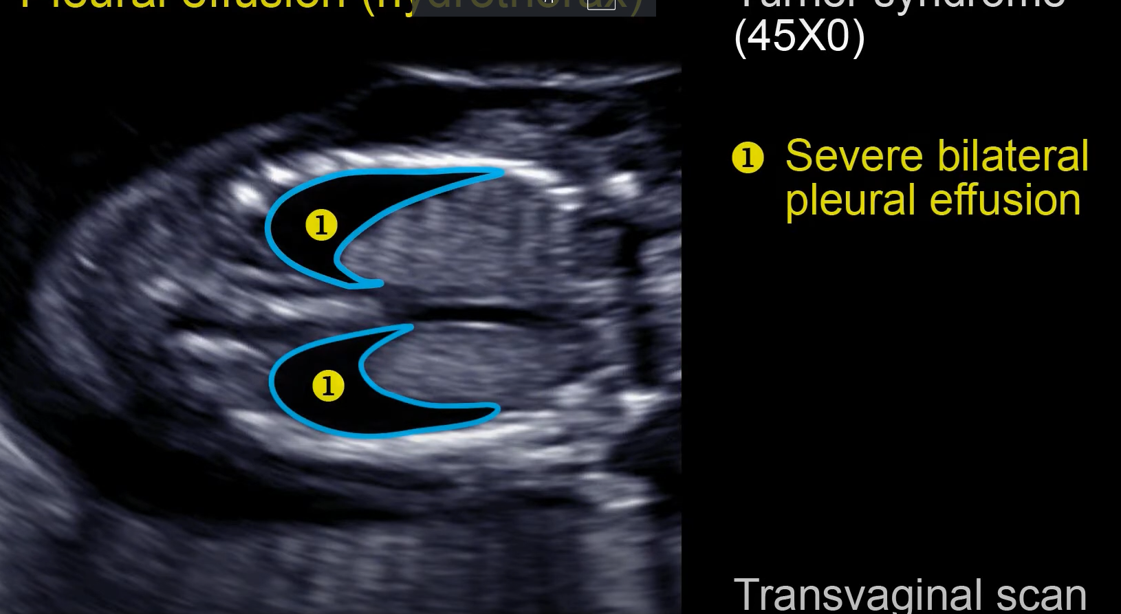 MRI Image Preview