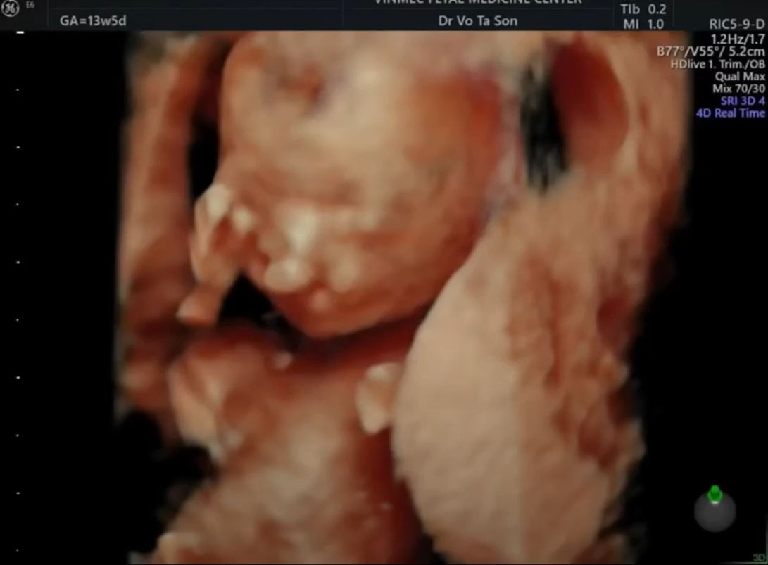 MRI Image Preview