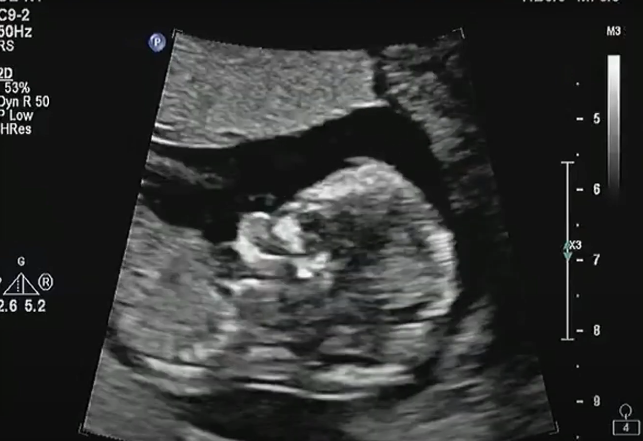 MRI Image Preview
