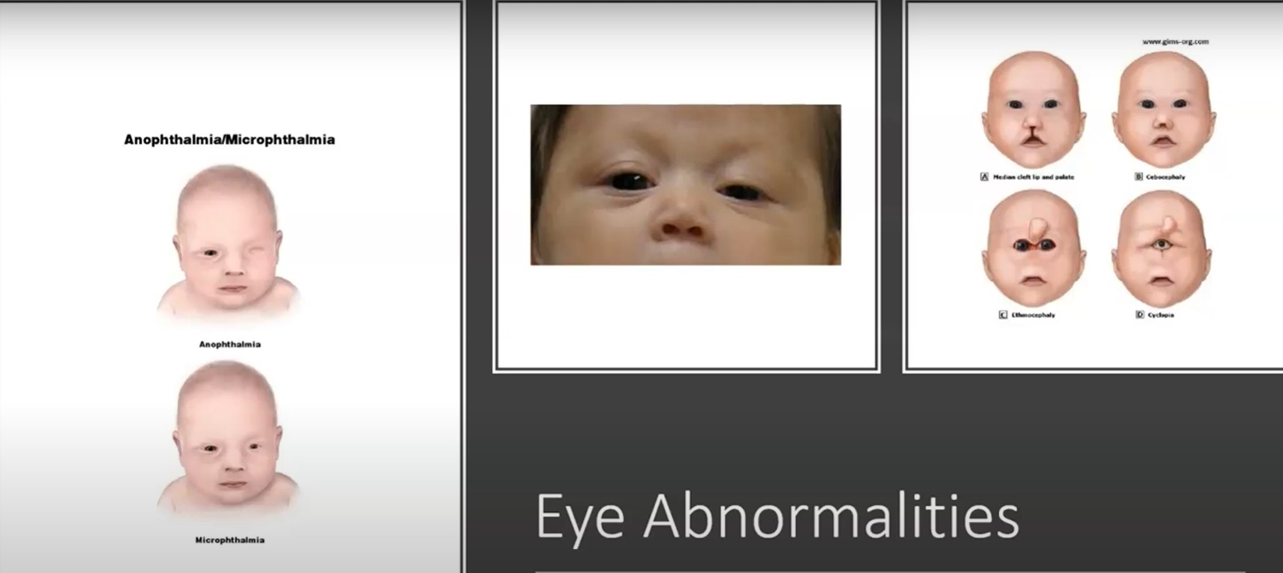 MRI Image Preview