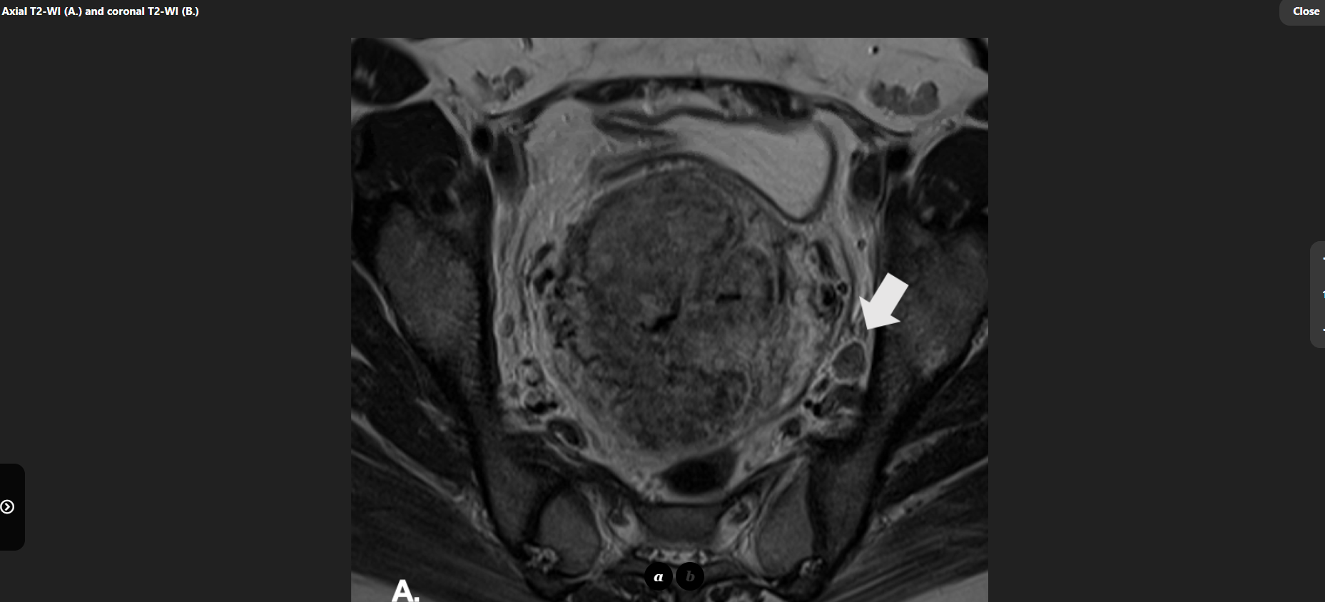 MRI Image Preview