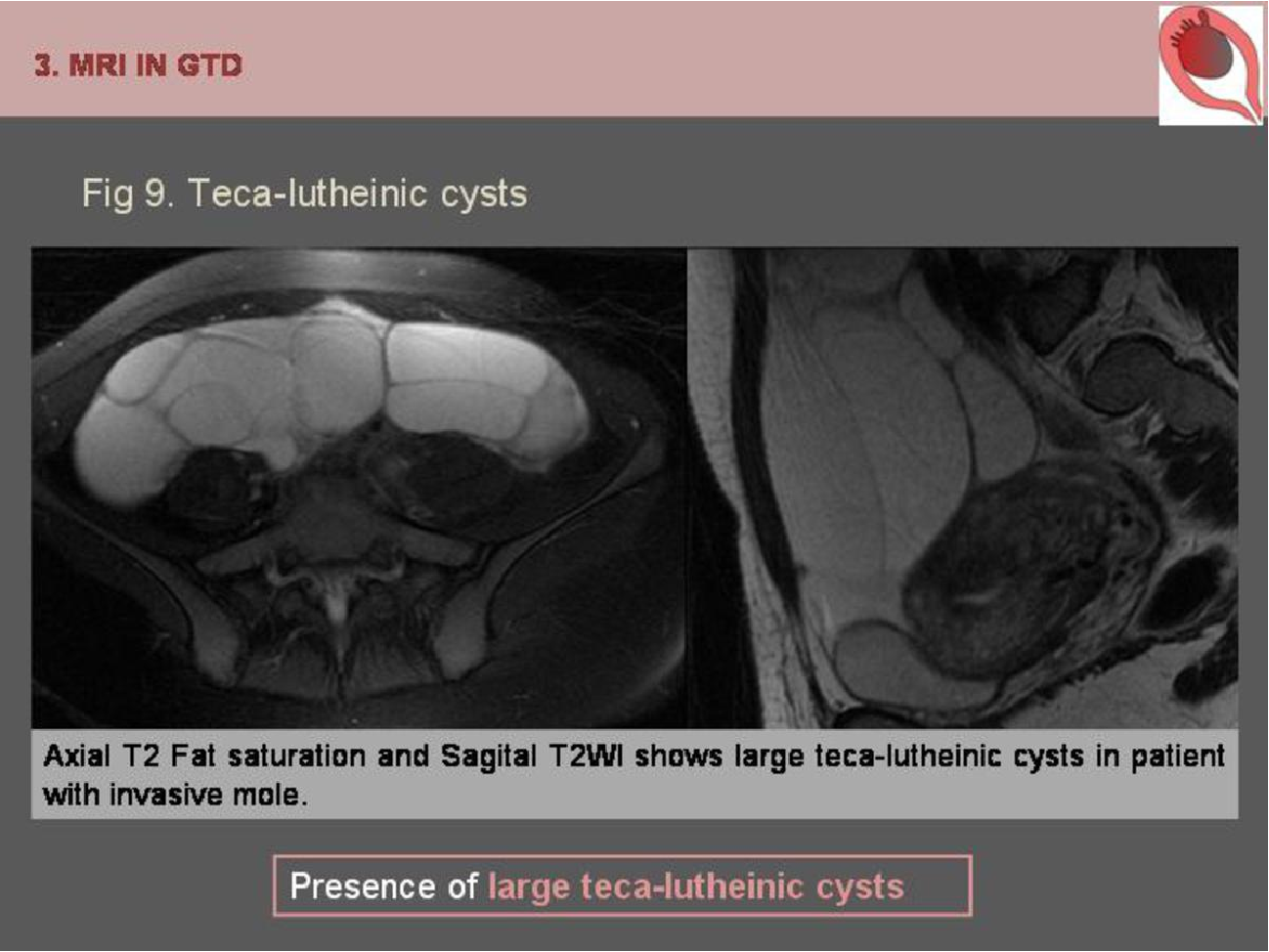 MRI Image Preview